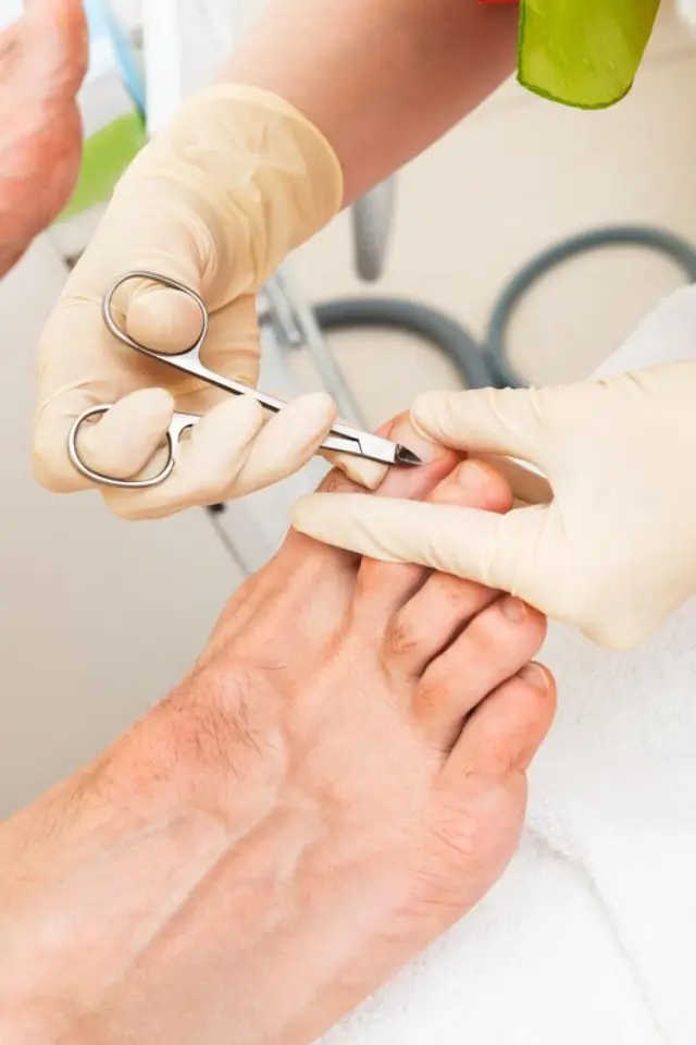 Ingrown toe nail treatment